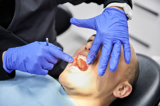 Best Emergency Dental Care for Broken or Chipped Teeth in Willow Grove, TX